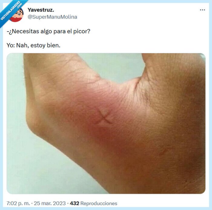 picor,rascarse,clavar,uñas