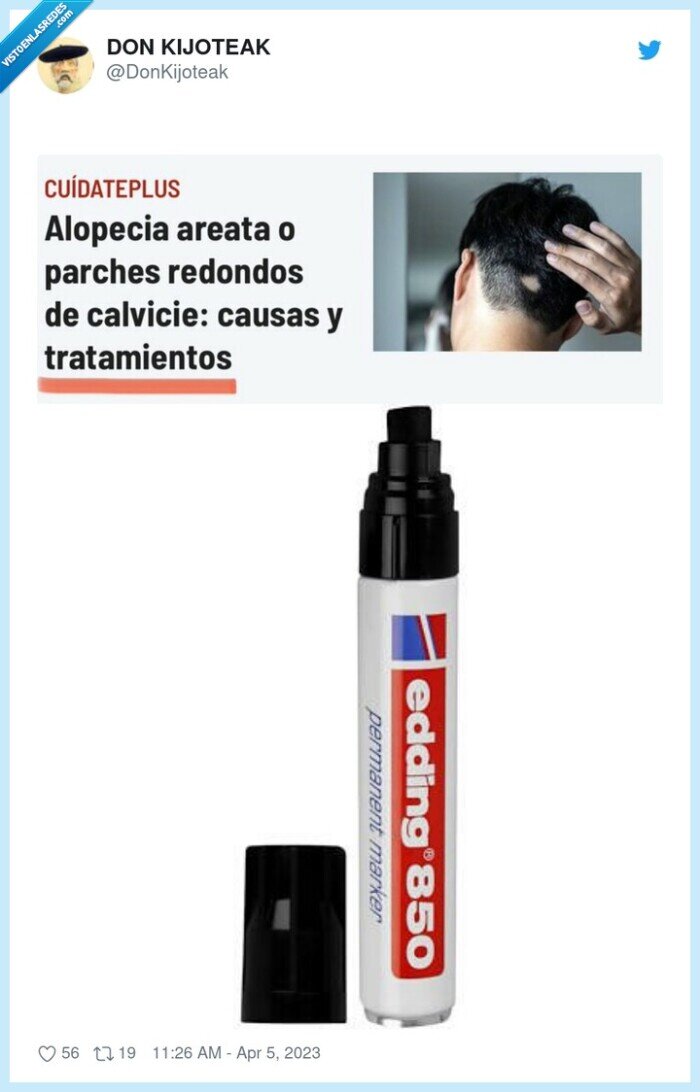 calvo,eding,rotulador,alopecia