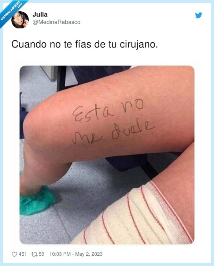 cirujano,pierna,marcar