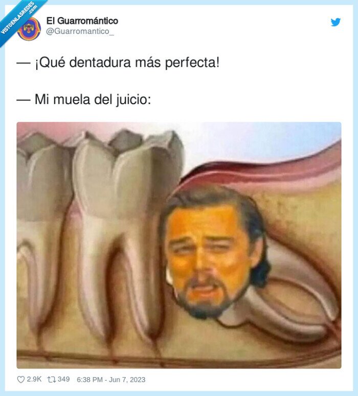 dentadura perfecta,juicio,muela,leonardo dicaprio