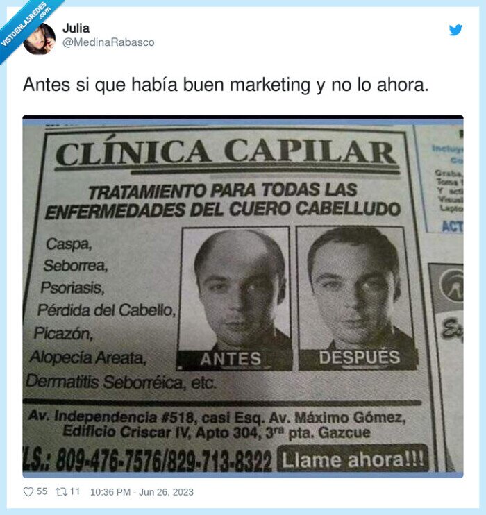 marketing,injertos,pelo,calvo,sheldon cooper