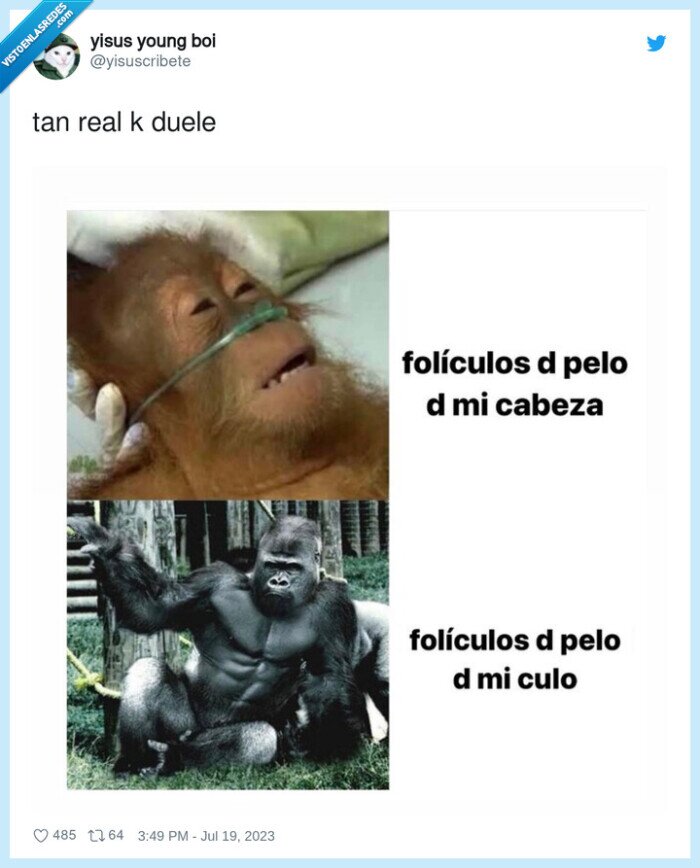 crecer,pelos,culo,cabeza,calvos