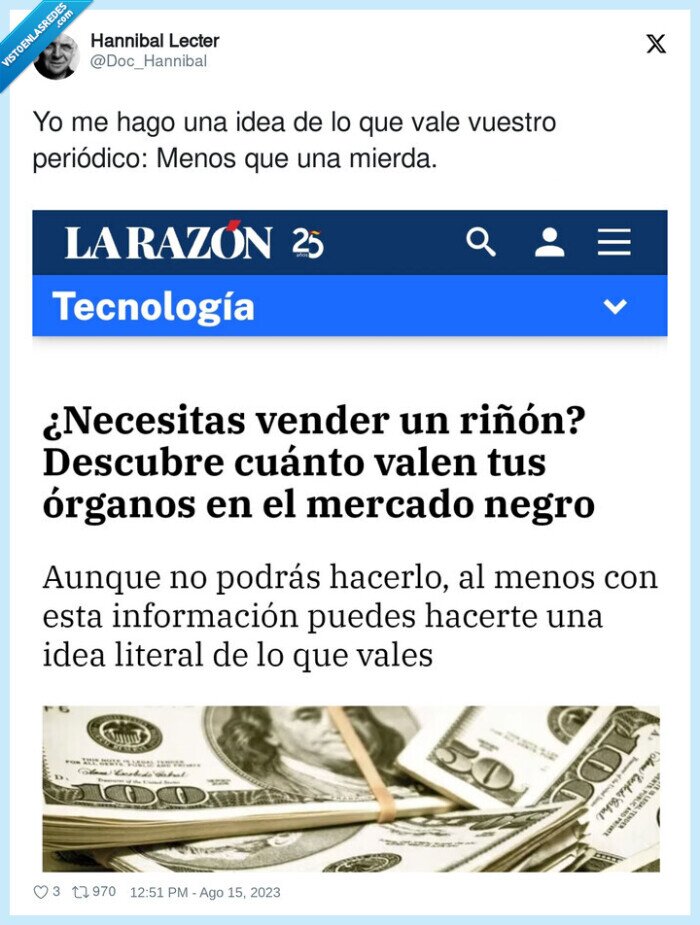 la razon,riñón,precio