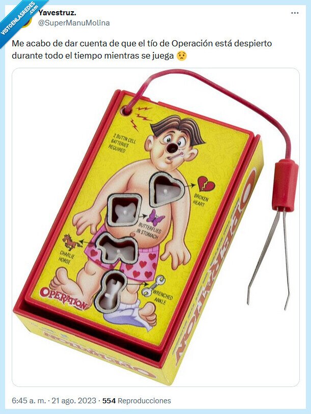 operación,despierto,juego