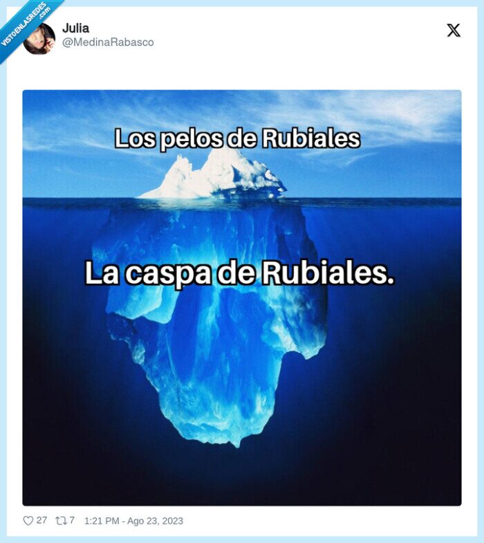 rubiales,caspa,iceberg,pelo