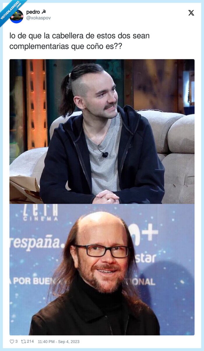 complementarias,cabellera,elxokas,santiago segura