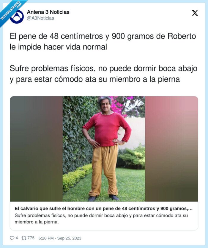 centímetros,físicos,problemas,miembro,roberto