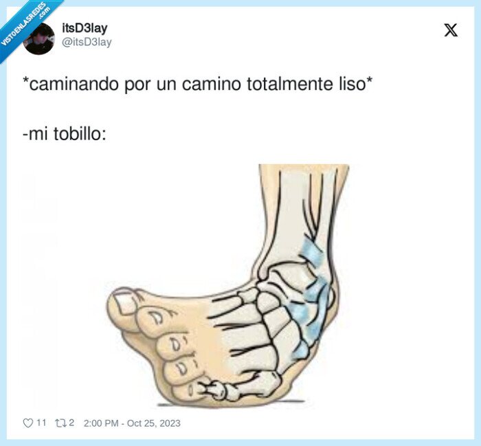 caminando,tobillo,camino,liso,torcer,esguince