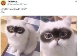Enlace a Ojeras permanentes por @supermanumolina