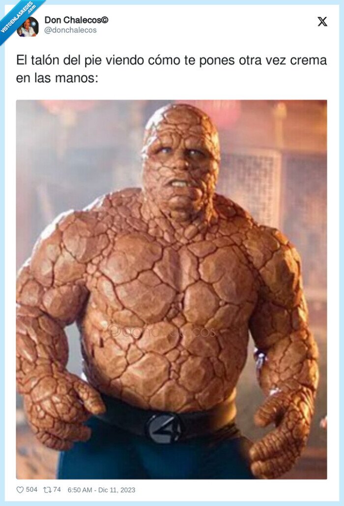 talón,pones,crema,manos