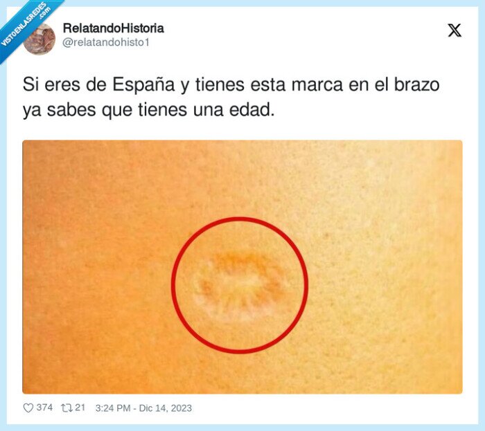 vacuna,españa,brazo,boomers