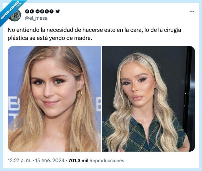 cirugía plástica,the boys,operacion,luz estelar,erin moriarty