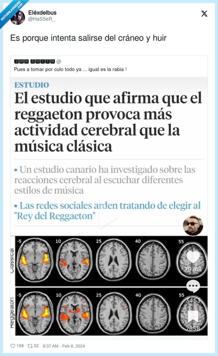 salirse,cráneo,reggaeton,actividad cerebral