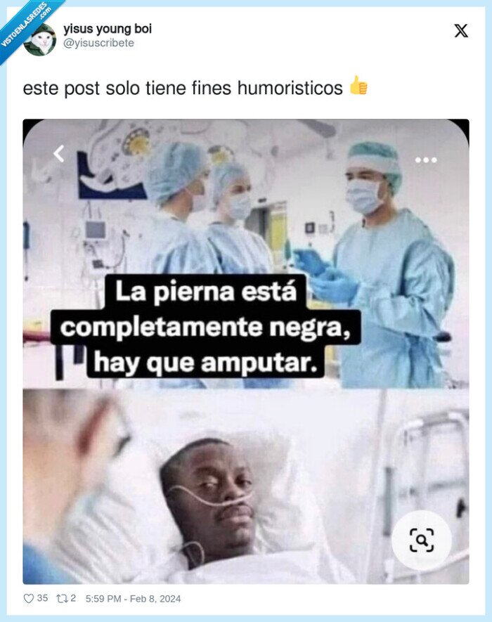 negro,amp utar,pierna