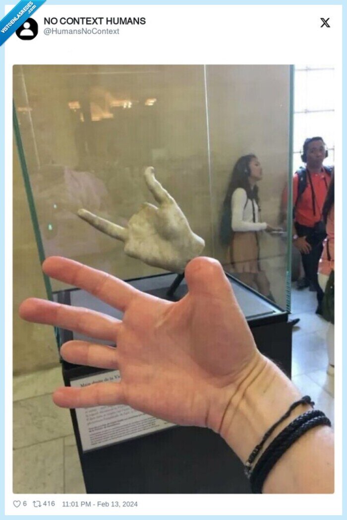 mano,dedos,faltar
