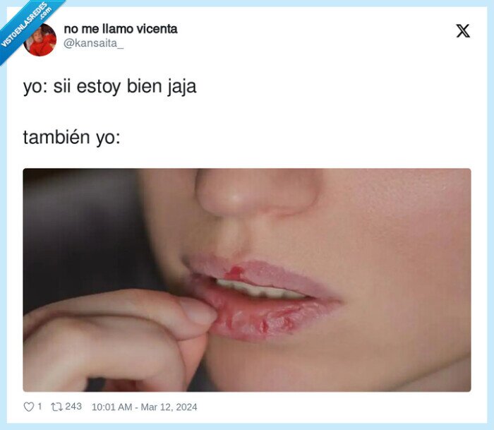 estar bien,labios,nervios,estirar