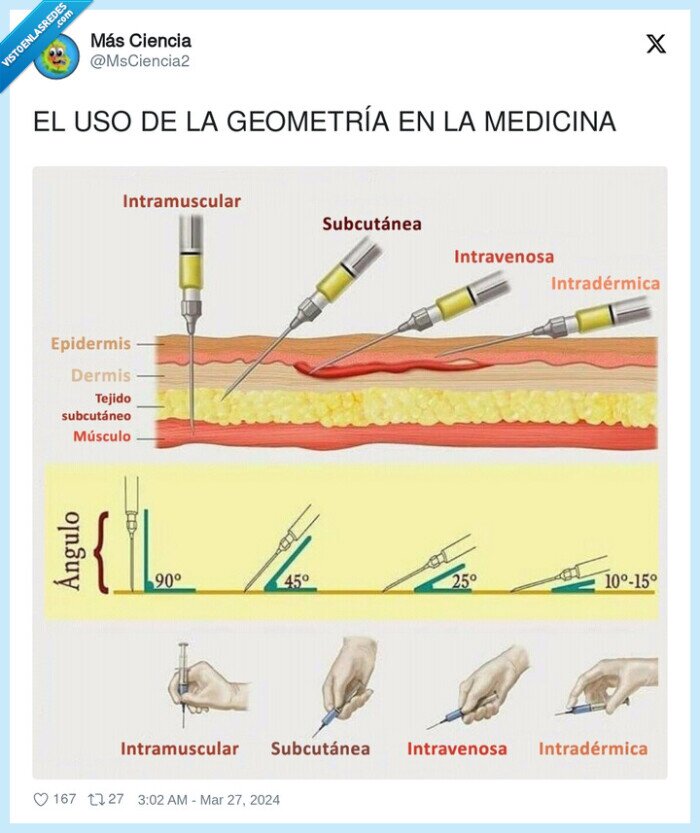 geometría,medicina,uso,angulos