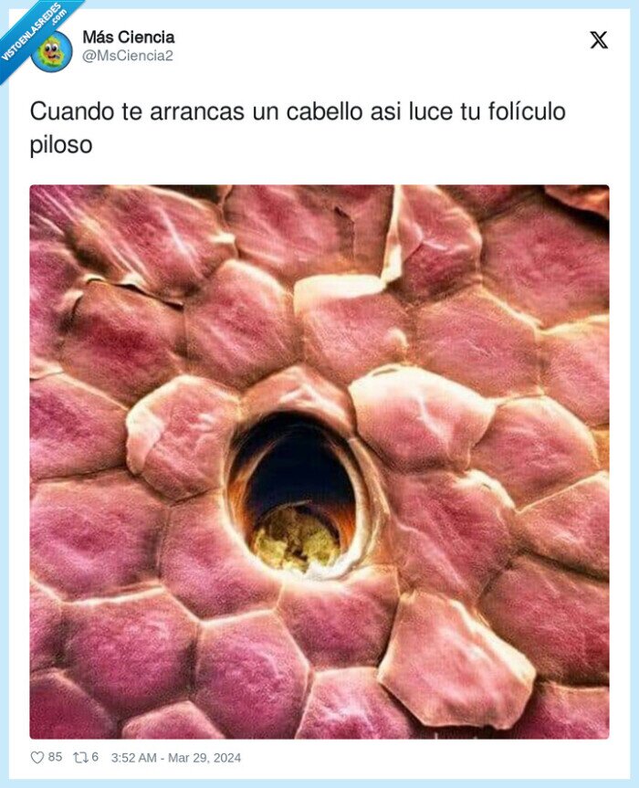 folículo,arrancasr,cabello,pelo