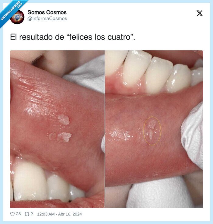 yagas,besos,bocas,compartir