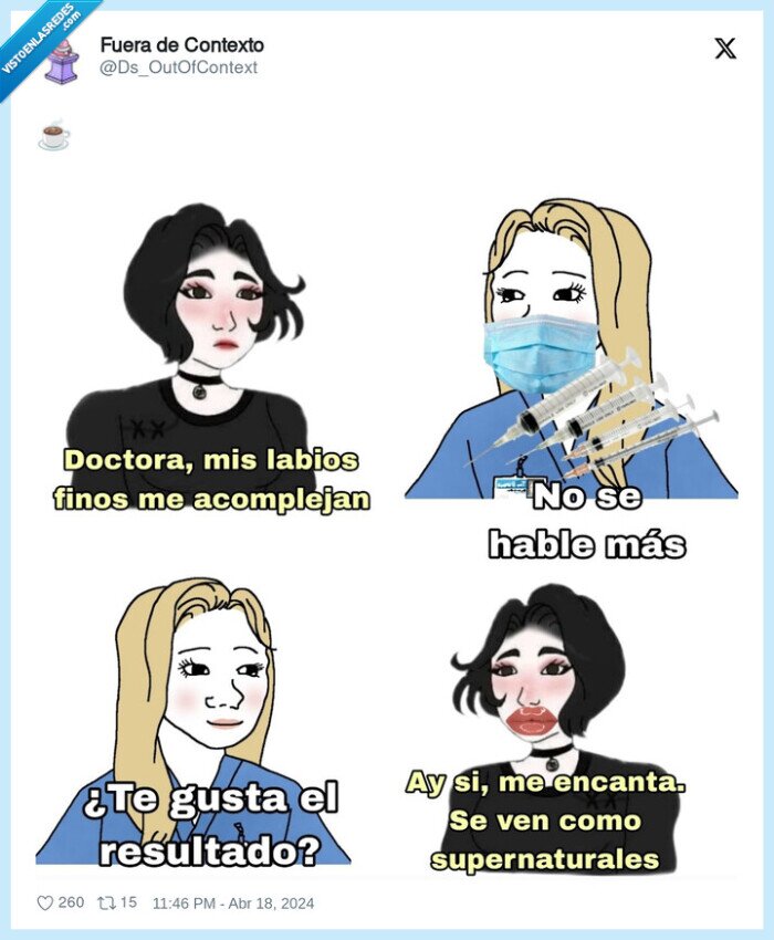 labios,ácido hialurónico,chicas