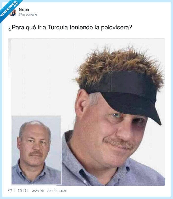 pelovisera,turquía,visera,gorra,pelo,calvo