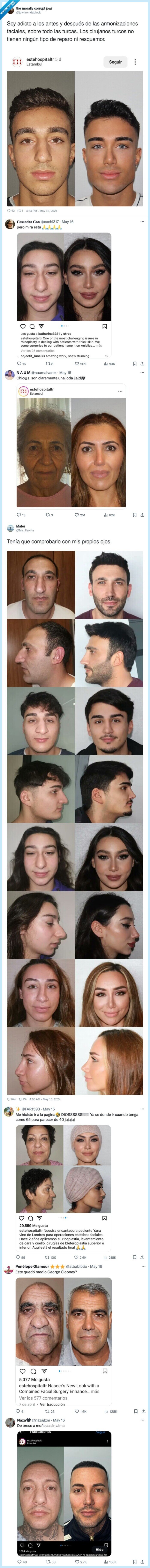 armonizaciones,faciales,cirujanos,turquia