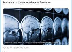 Enlace a Las mejores respuestas a la noticia de que reviven un cerebro humano congelado manteniendo todas sus funciones