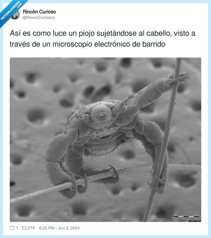 sujetarse,microscopio,cabello,piojo,pelo