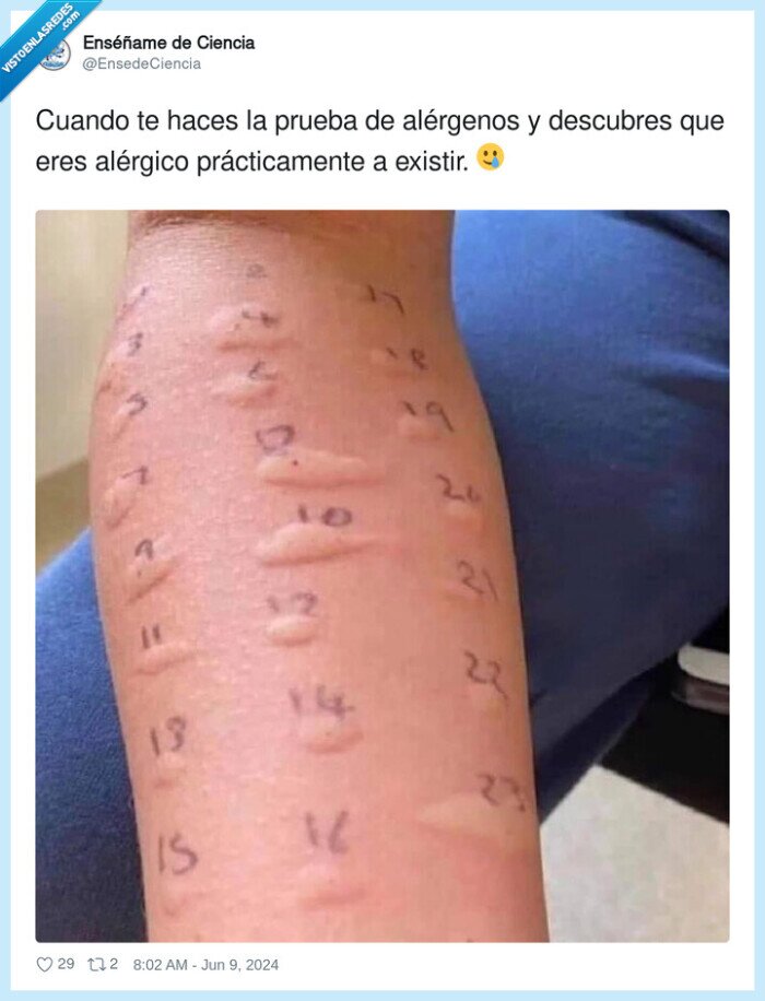 alérgenos,descubrir,alérgico,pruebas