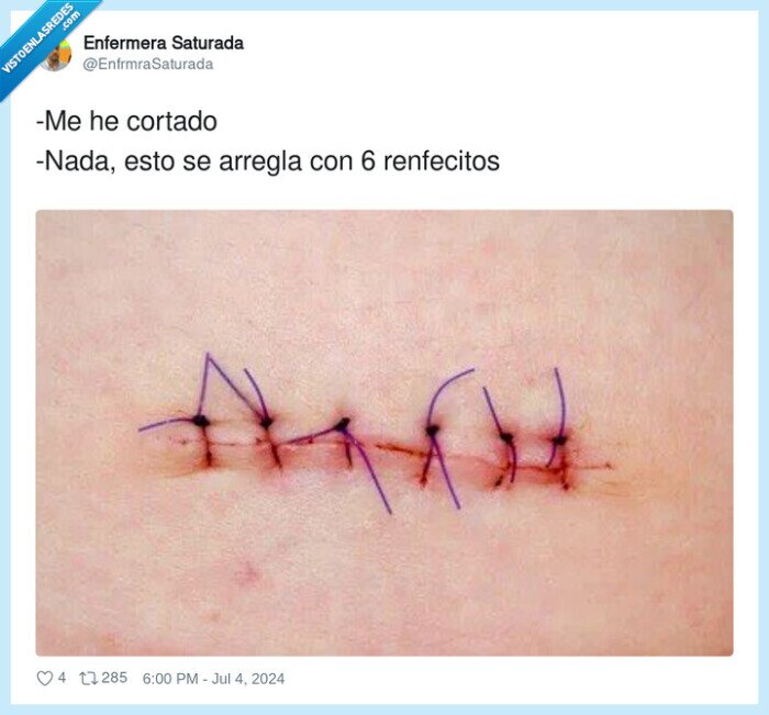 renfecitos,cortado,arreglar,puntos