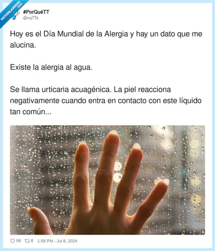 alergia,acuagénica,urticaria,reaccionar,líquido,agua