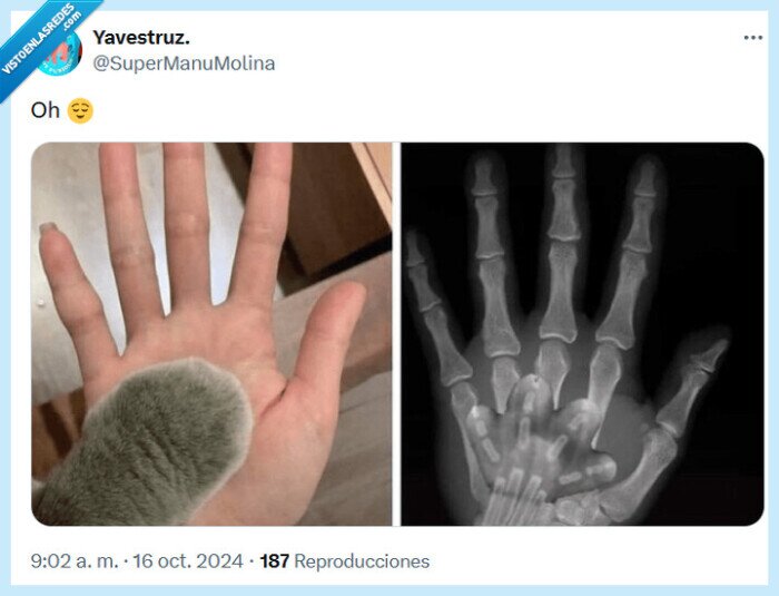 pata,mano,radiografía