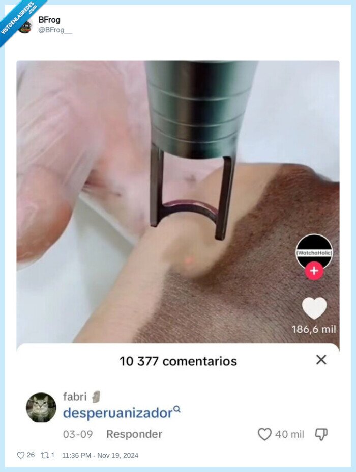 tatuaje,borrar,peruanos