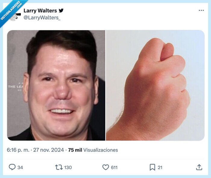 nariz,rota,andy y lucas