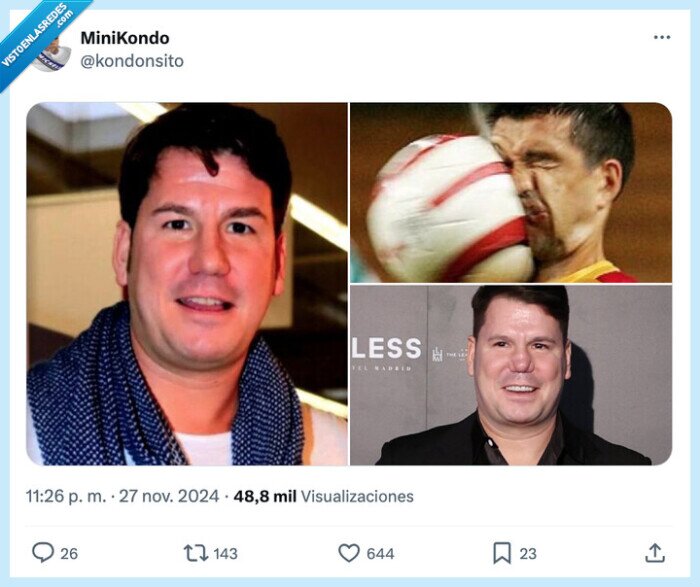 lucas,nariz,andy,balonazo