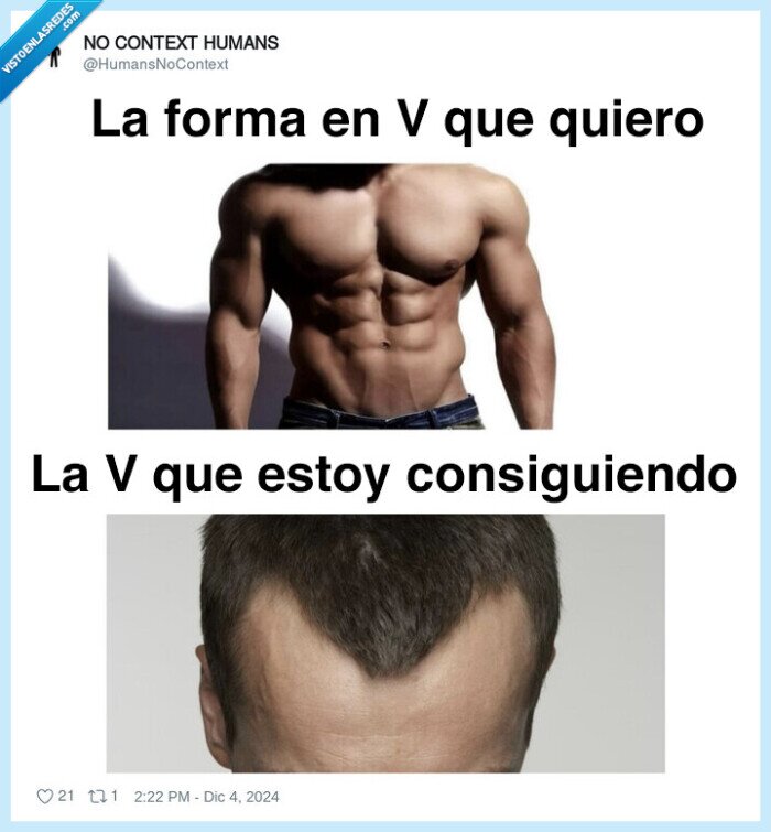 v,forma,cadera,calvo