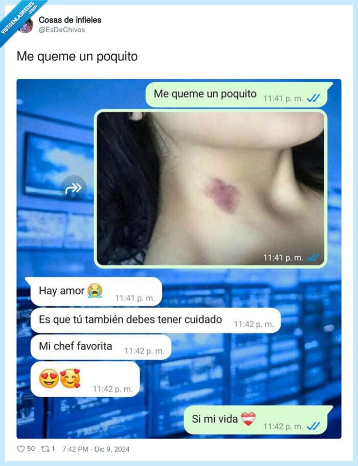 chupeton,excusa,novia,quemadura