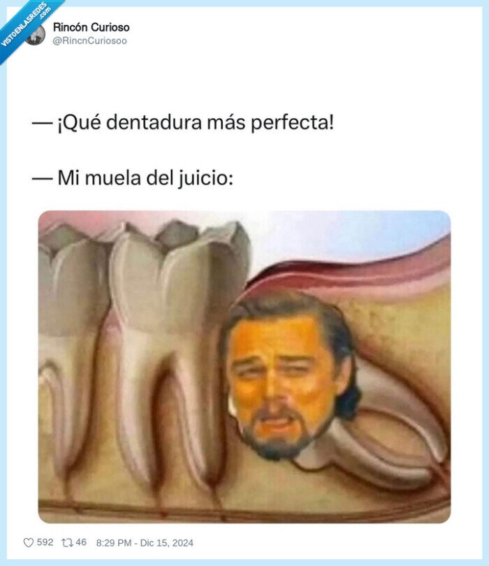 muelas,juicio,leo dicaprio
