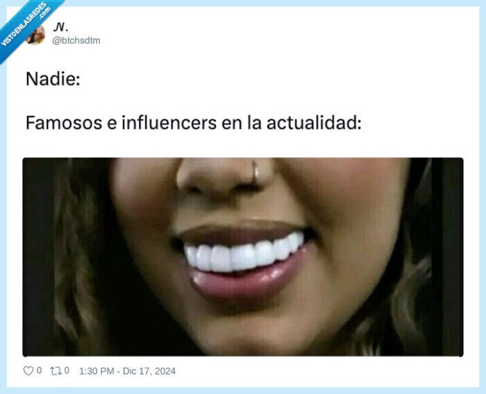 dentadura,blanca,dientes,famosos,blanqueo