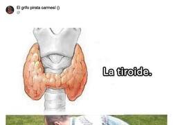 Enlace a No te reirás tanto cuando sufras de ello, por @ErigolDelViento