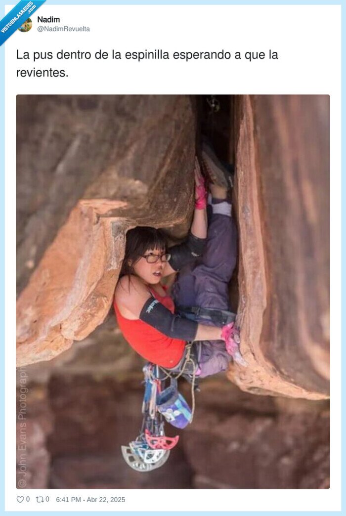 espinilla,esperando,revientes,pus