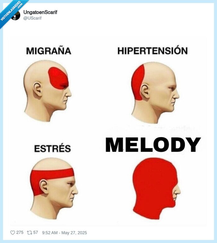 melody,migraña,turra,pesada