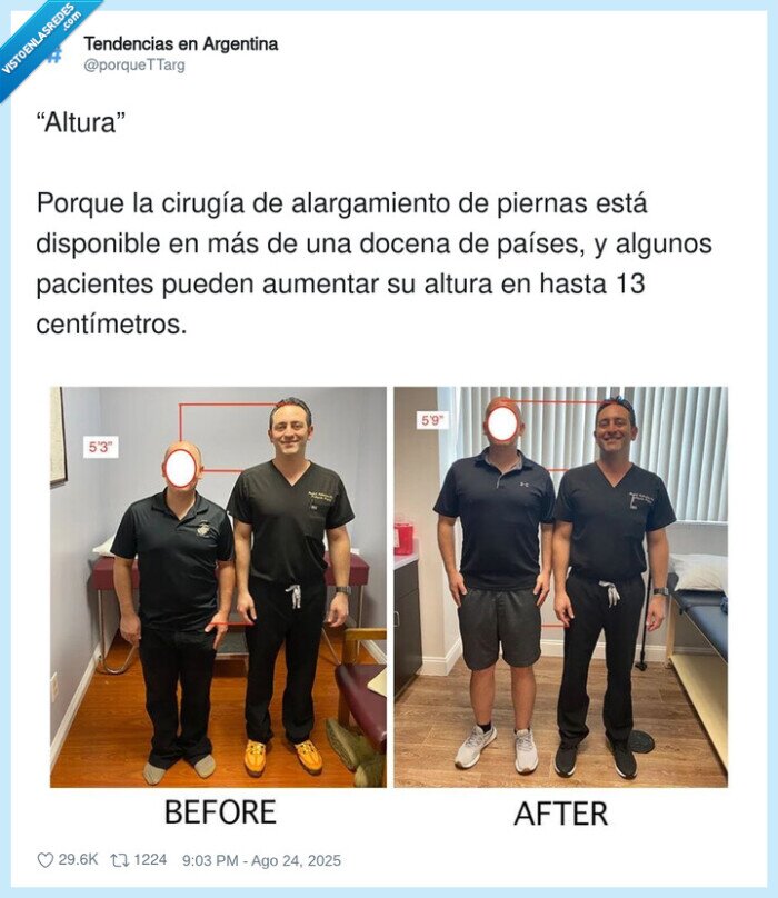 altura,alargamiento,centímetros,pacientes,cirugía