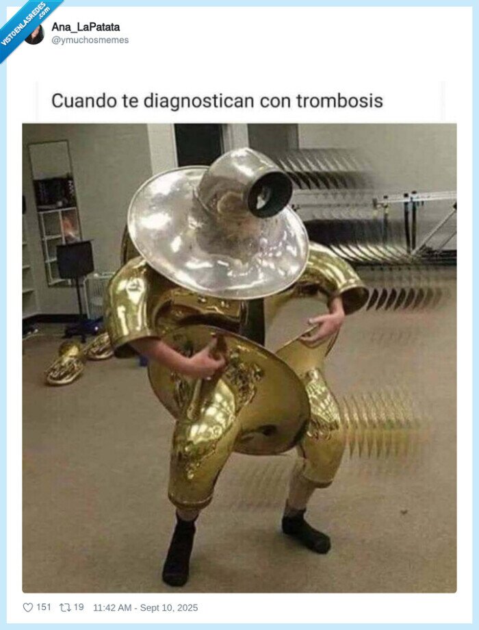 trombosis,enfermedad,trombón