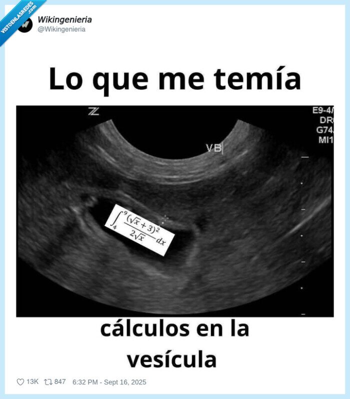 calculos,vesicula,formula