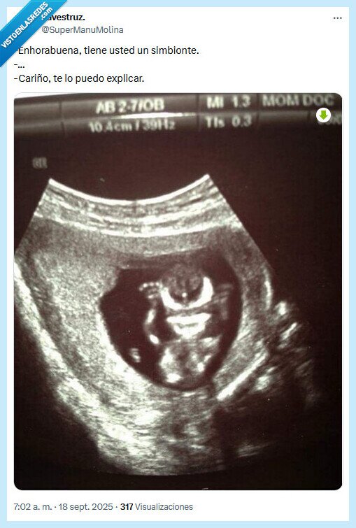 simbionte,embarazo,marvel,venom