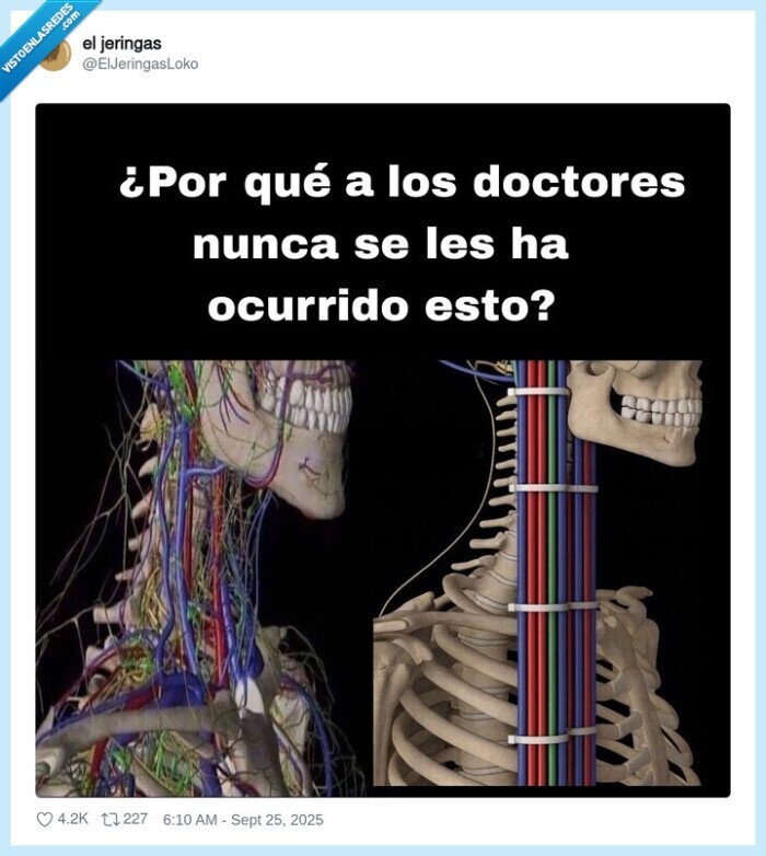 bridas,doctores,sistema nervioso,cuerpo humano