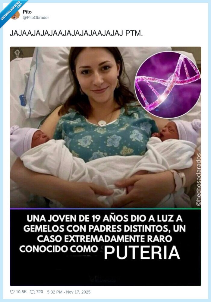 gemelos,caso raro,meme,médico,19_años