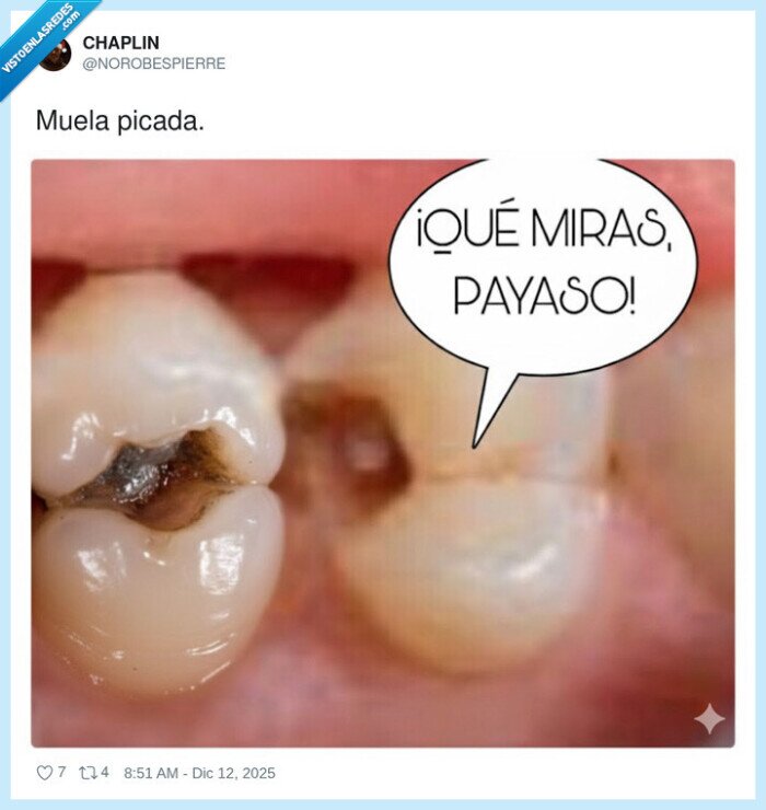 diente,picado,payaso,muela