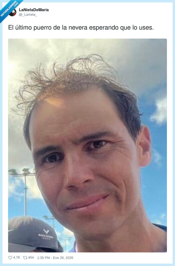 puerro,peinado,rafa nadal